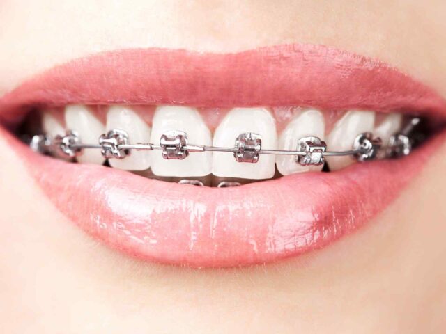 post_05 https://dentistgarden.mom/wp-content/uploads/2020/01/post_05-640x480.jpg